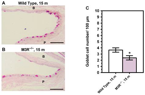 Ijms Free Full Text Aged Mice Devoid Of The M3 Muscarinic Acetylcholine Receptor Develop