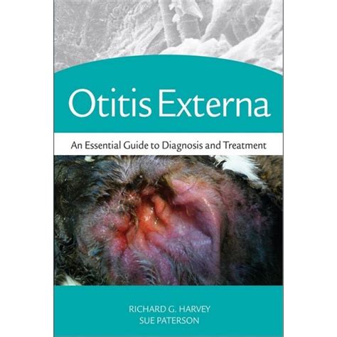 Otitis Externa An Essential Guide To Diagnosis And Treatment
