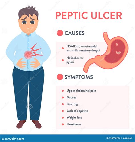 Causes And Symptoms Of Peptic Ulcer Stomach Disease Stock Vector
