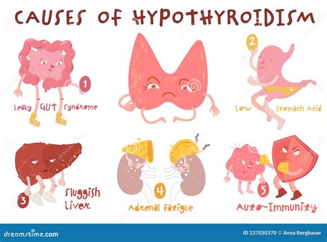 causes of hypothyroidism thyroid gland disease endocrine system disorder medical vector