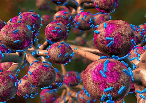 Influenza or flu is a contagious respiratory illness, that is caused by the influenza virus. Bacterial lung infection - Stock Image - M240/0634 ...