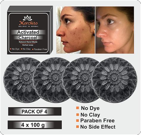 Buy Mahalaxmi Creation Skin Whitening Acne Blackheads Anti Wrinkle