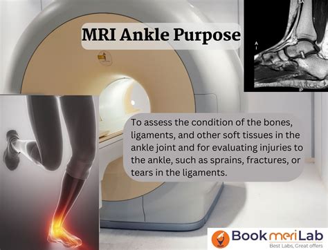 Mri Ankle Price Purpose Procedure And Results 2023 • Bookmerilab