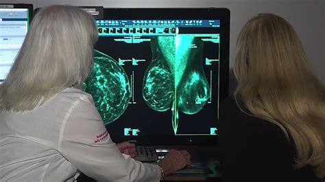 women are now recommended to start mammograms at age 40