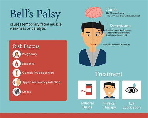 Bells Palsy Symptoms Causes And Treatment Birla Fertility And Ivf