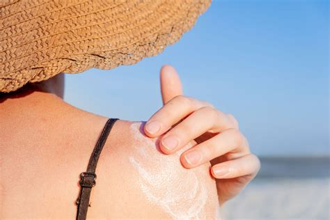 How To Treat Sunburn Fast 13 At Home Sunburn Cures That Work