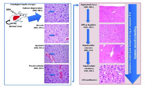 The Sequences Of The Main Events In DEN Induced Liver Tumors In Mice