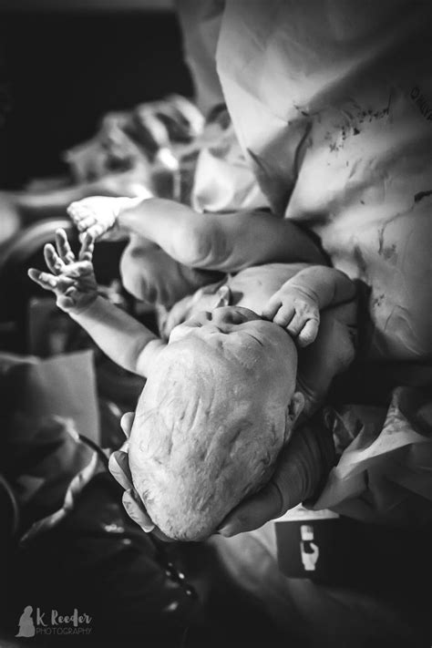 Incredible Photos Show Cone Shaped Head Of Newborn Baby The Natural