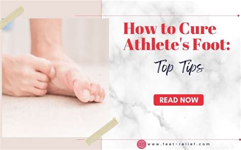 How To Cure Athletes Foot Top Tips Feet Relief