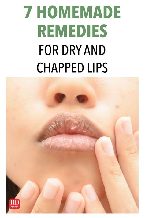 7 Homemade Remedies For Dry And Chapped Lips 7 Homemade Remedies For