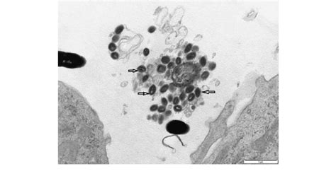 Lumpy Skin Disease Virus Particles Arrows Seen Under Electron
