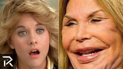 Famous People Who Are Unrecognizable Today Bad Celebrity Plastic Surgery Celebrity Plastic