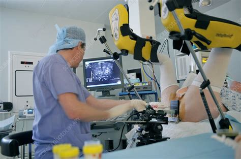 Prostate Biopsy Surgery Stock Image C0018055 Science Photo Library