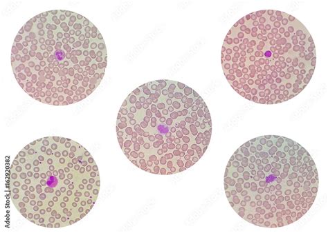 Blood Smear Under Microscope Present Neutrophil Lymphocyte Monocyte