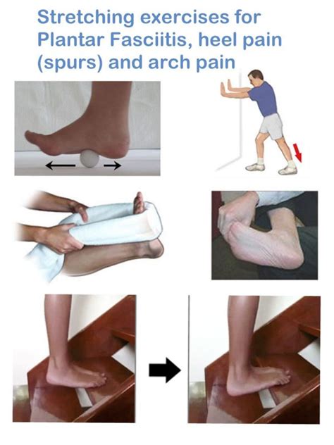 Effective Ways To Get Rid Of Painful Heel Spurs Incredible Natural