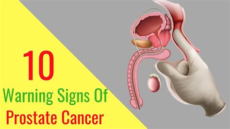 Cancer screening means looking for cancer before it causes symptoms. Prostate Cancer Symptoms - 10 Warning Signs of Prostate ...