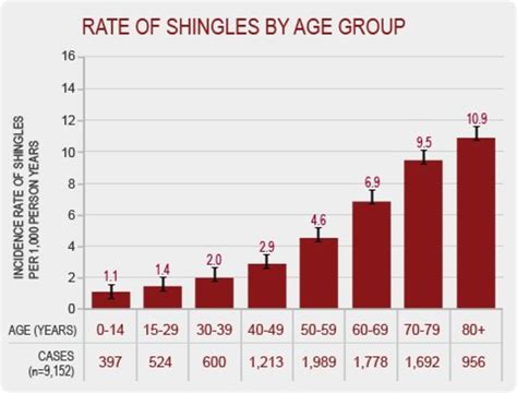 Shingles A Serious And Painful Disease Healdove