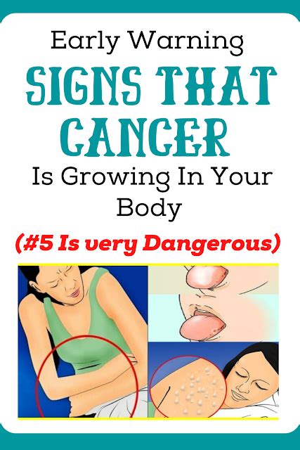 Early Cancer Warning Signs 5 Symptoms You Shouldnt Ignore Nutrition Health