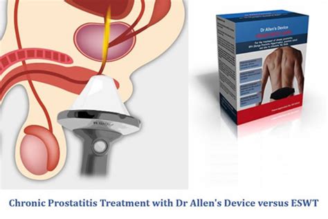 Treatment Of Chronic Prostatitis Chronic Pelvic Pain With Dr Allen S Device Versus ESWT