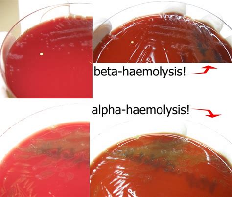 Streptococcus Alpha Vs Beta Haemolysis A Photo On Flickriver
