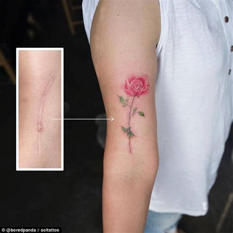 Bored Panda Users Show Scars Turned Into Tattoos Daily Mail Online