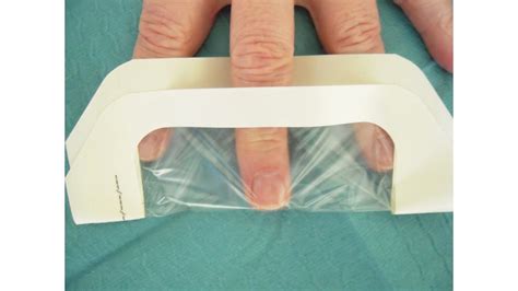 Versorgung Von Fingerkuppenverletzungen Mit Semiokklusivverbänden