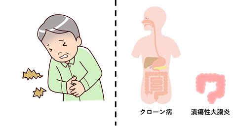 から お砂糖いらないの〜 夜 作っておけば 朝食に出せるから バタバタの朝に良き #潰瘍性大腸炎 #お菓子作り pic.twitter.com/iiv8jnv8z0. 潰瘍性大腸炎治療薬、クローン病治療薬