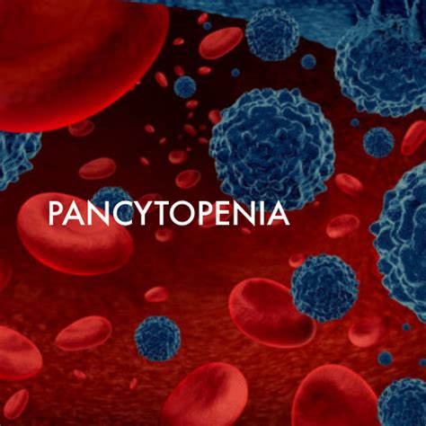 Pancytopenia Haemato Oncology Care Centre