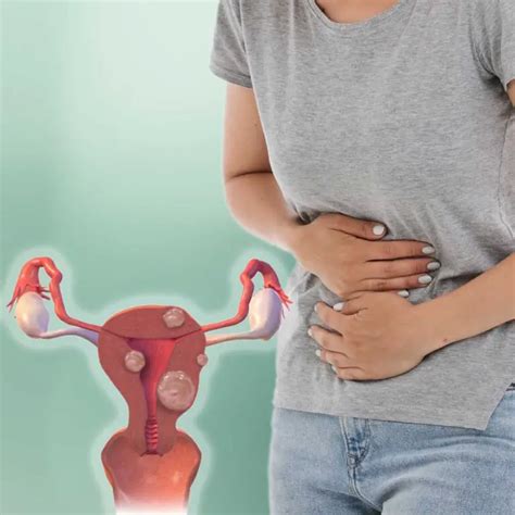 Uterine Fibroids Symptoms And Risk Factors You Should Be Aware About