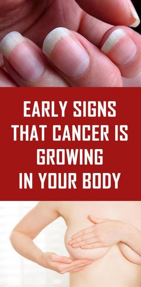 Early Signs That Cancer Is Growing In Your Body Healhty And Tips