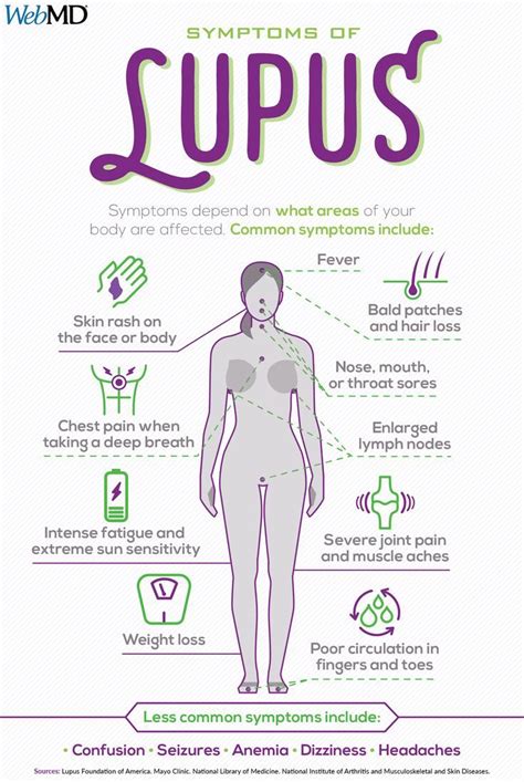 slideshow a visual guide to lupus webmd guide lupus slideshow visual webmd lupus