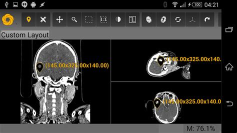 Dicom stands for 'digital imaging and communications in medicine'. 5 Best Free DICOM Viewers & PACS Clients for Android ...
