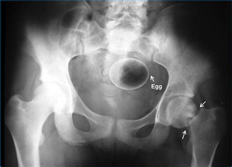 Kostenlose private porno filme von menschen wie dir und mir. World's worst A&E 'sexual misadventure' X-rays revealed ...