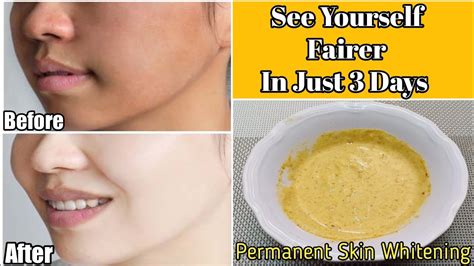 Permanent Skin Whitening Magical Remedy See Yourself Fairer In 3 Days