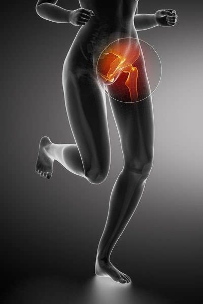 It joins the lower limb to the pelvic girdle. Groin Pain - Blog by Kara Giannone - Total Physiocare