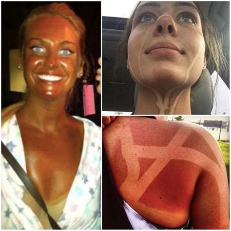 Funny Tanning Fails That Had Us Reaching For Sunscreen