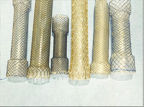 Currently Available Fully Covered Self Expandable Metal Stent In Usa