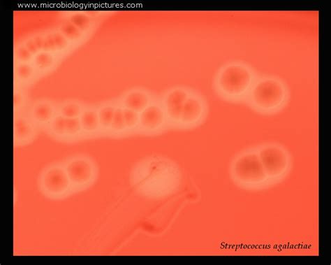 Streptococcus Agalactiae Colony Morphology Colonies Of Group B Beta Hemolytic Streptococci