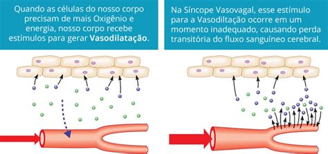 Es importante no confundir la pérdida verdadera de la. Síncope Vasovagal (desmaio comum): tudo sobre | MedSimples