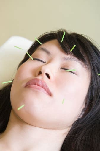 Wanita Dengan Mata Tertutup Menerima Terapi Akupunktur Wajah Foto Stok