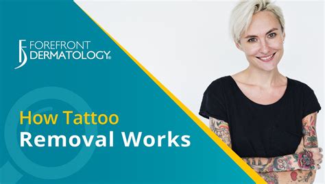 How Tattoo Removal Works Forefront Dermatology