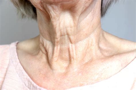 Sagging Neck Causes And How To Tighten 7 Non Surgical Home Tips