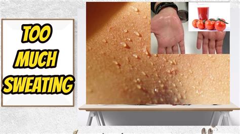 Sweating Home Remedies For Too Much Sweating Youtube