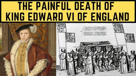 The Painful Death Of King Edward Vi Of England The Boy Tudor King