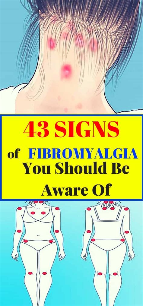 [10] patients tend to report worse symptoms when eating certain foods like red meat, alcohol, and soda, whereas fish and berries are reported to improve symptoms. 43 Signs of Fibromyalgia You Should Be Aware Of | Signs of