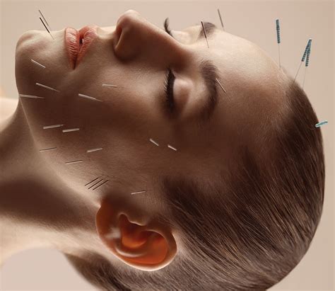 Cosmetic Acupuncture Nuvo