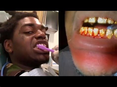 But it really depends on what condition it's in. What is a grill teeth - buzzpls.Com