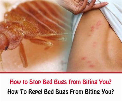 How To Repel Bed Bugs From Biting You
