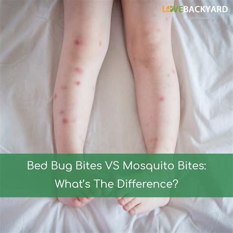 Insect Bites Tips And Reviews Love Backyard
