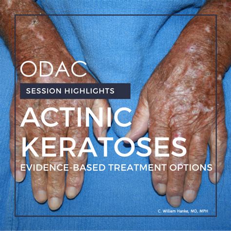 Actinic Keratoses Evidence Based Treatment Options Next Steps In